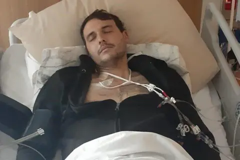 16a62990-39a9-11f0-8237-2dff5f2facd7 16a62990-39a9-11f0-8237-2dff5f2facd7 Luke Melling A man lies in a hospital bed with his eyes closed and tubes attached to his chest. He is wearing a black hoodie, open at the chest. A white blanket covers the lower part of his body. 'My life was saved by a stranger on the other side of the world' 16a62990 39a9 11f0 8237 2dff5f2facd7