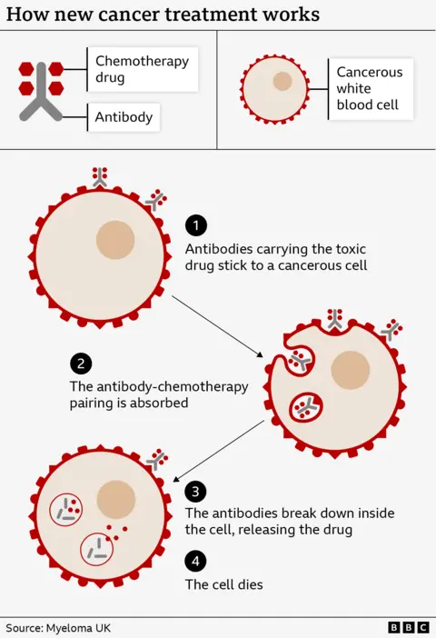 25b0ac20-46ac-11f0-bbaa-4bc03e0665b7 25b0ac20-46ac-11f0-bbaa-4bc03e0665b7 Graphical illustration showing a Y-shaped antibody with red dots, representing the chemotherapy drug, attached. These stick to the surface of a round cancerous cell. The graphic then shows the combo entering the cell, the Y-shaped antibody breaking down and the red dots being released inside the cell. World-first blood cancer therapy to be given on NHS 25b0ac20 46ac 11f0 bbaa 4bc03e0665b7