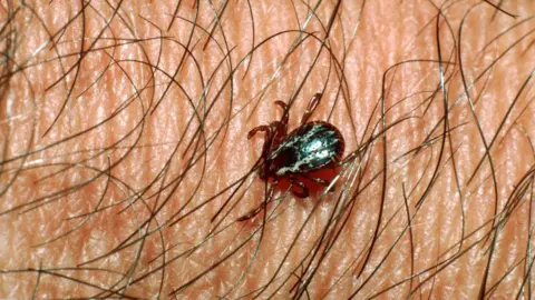 c0fe9f70-46b6-11f0-98c9-f388968ae068 c0fe9f70-46b6-11f0-98c9-f388968ae068 Getty Images A tick crawling through body hair on a persons skin How to stay safe at festivals this summer c0fe9f70 46b6 11f0 98c9 f388968ae068