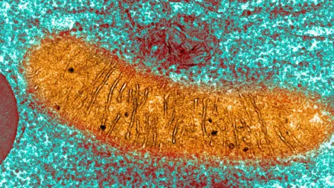 4cab2890-5e77-11f0-83f4-2ff5c528359d 4cab2890-5e77-11f0-83f4-2ff5c528359d Getty Images An orange sausage shaped blob on a blue grainy background Babies made using three people's DNA are born free of hereditary disease 4cab2890 5e77 11f0 83f4 2ff5c528359d