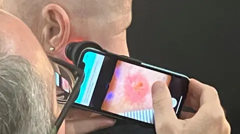 51626e20-566b-11f0-9fc1-5b48baa78cfc 51626e20-566b-11f0-9fc1-5b48baa78cfc BBC A clinical photographer taking a digital image of a patient's skin lesion which will be passed onto the consultant for their opinion diagnosis and if necessary treatment Digital imaging cuts waiting times for skin cancer 51626e20 566b 11f0 9fc1 5b48baa78cfc