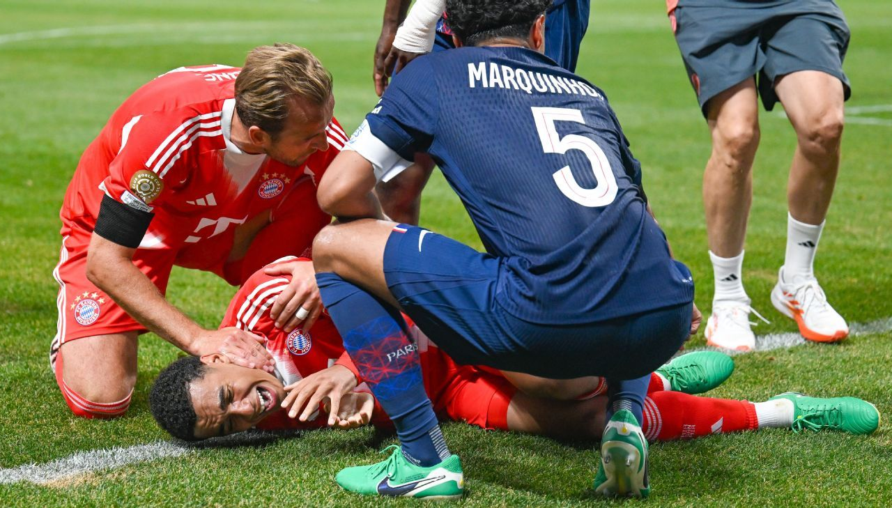 wp-header-logo-252-1280x729 wp-header-logo-252-1280x729 Musiala taken to hospital after injury vs. PSG wp header logo 252 1280x729